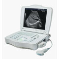 Volldigitaler Laptop-Ultraschallscanner